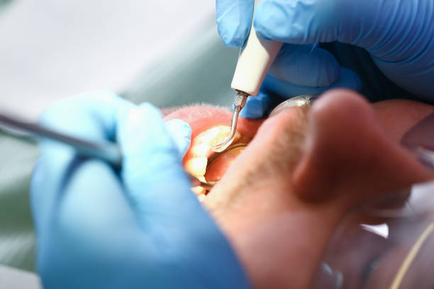 Best Emergency Denture Repair in Sausalito, CA